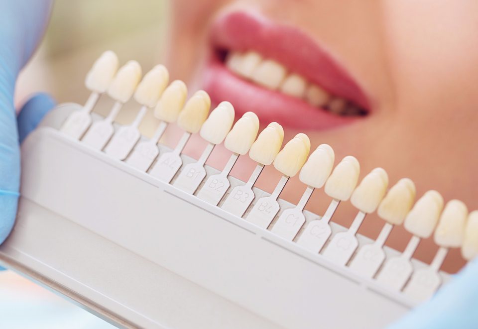 wybielanie zębów toruń - esthetic dental clinic
